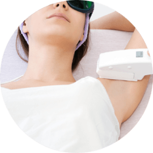 Epilation laser