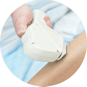 Epilation laser
