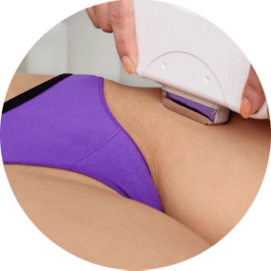 Epilation laser