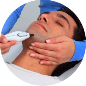 Paramètres de l'épilation laser