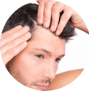 Micro-greffe de cheveux