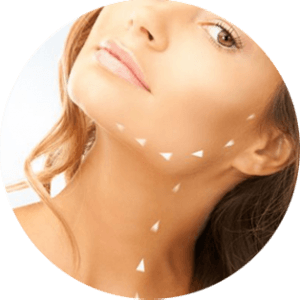 Lipoaspiration du cou