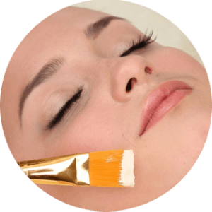 Déroulement du peeling
