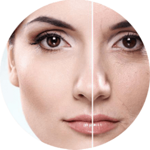 Résultats du peeling
