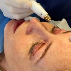 Blépharoplastie médicale