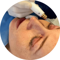 Blépharoplastie médicale